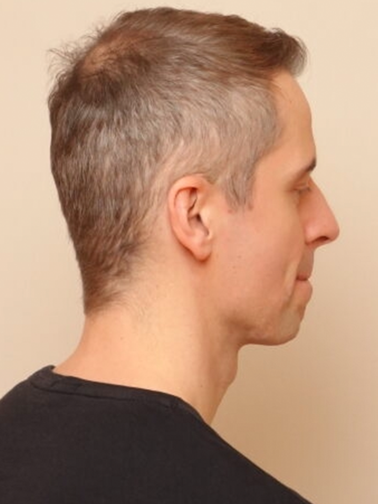 Immagine del modello con colore dei capelli biondo Scuro di khadi (Daniel)